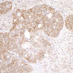 Detection of human EML4 by immunohistochemistry.