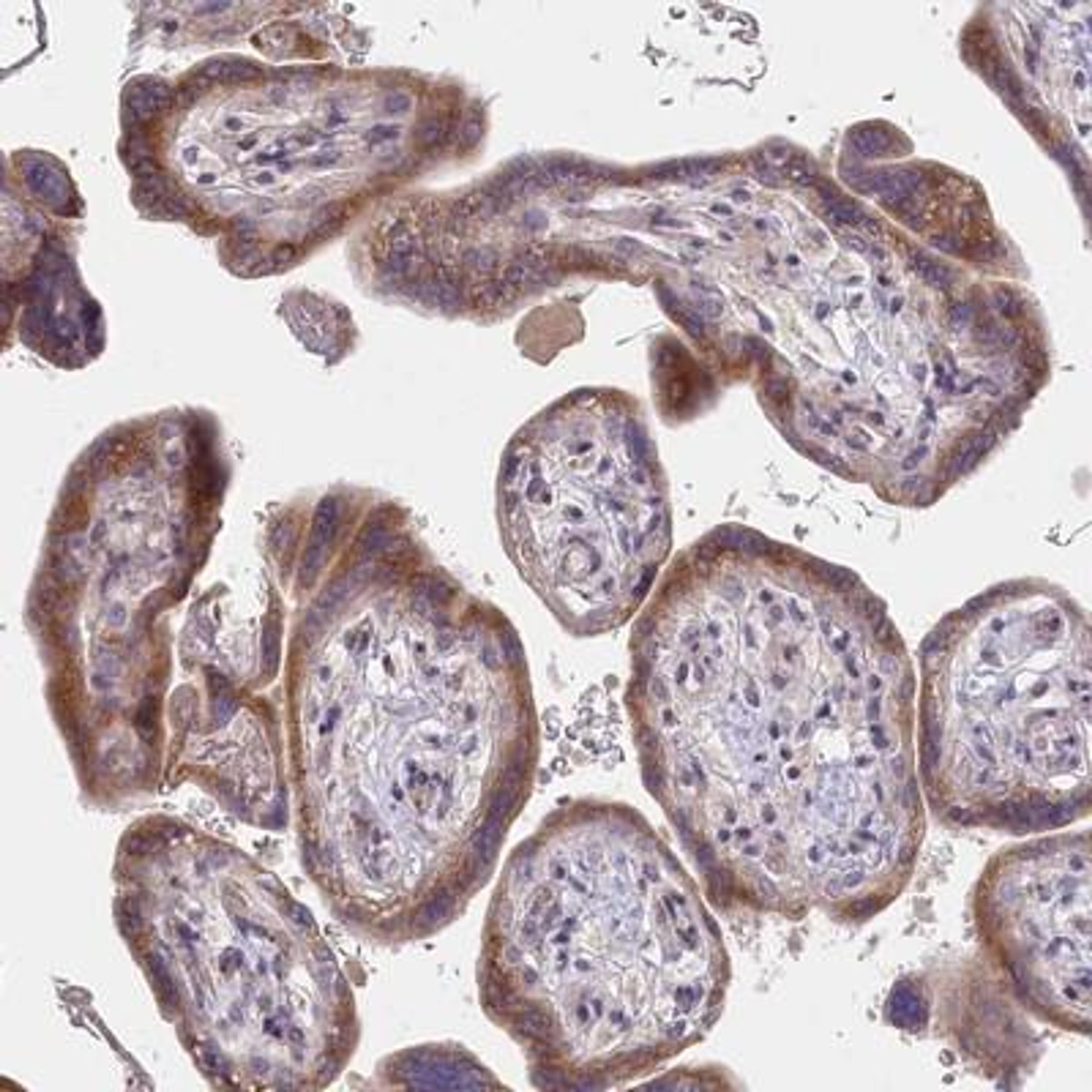 Immunohistochemistry-Paraffin: Protein O-Glucosyltransferase 1/POGLUT1/KTELC1 Antibody [NBP1-90311] - Staining of human placenta shows moderate cytoplasmic positivity in trophoblastic cells.