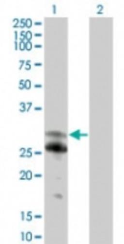 Western Blot: NFAM1 Antibody [NBP2-24943] - Analysis of NFAM1 in 1) transfected 293T cells and 2) untransfected 293T cells using this antibody at 1:500.