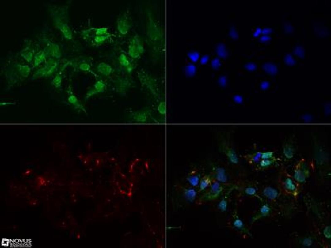 Immunocytochemistry/Immunofluorescence: FOXO1A Antibody (83N7F8) [NBP2-31376] - FOXO1A antibody was tested in Ntera2 cells with Dylight 488 (green). Nuclei and alpha-tubulin were counterstained with DAPI (blue) and Dylight 550 (red). An antibody concentration of 0.1 ug/ml was used. Image objective 40x.