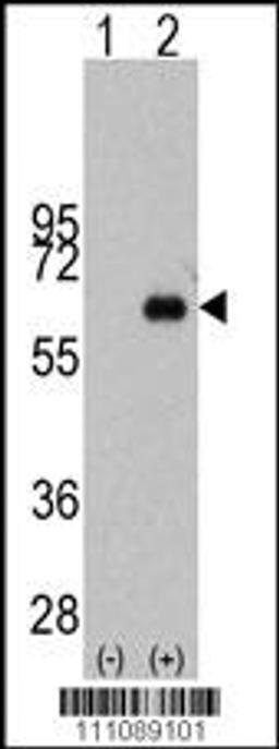 Western blot analysis of MYC using rabbit polyclonal MYC Antibody (S62) using 293 cell lysates (2 ug/lane) either nontransfected (Lane 1) or transiently transfected with the MYC gene (Lane 2).