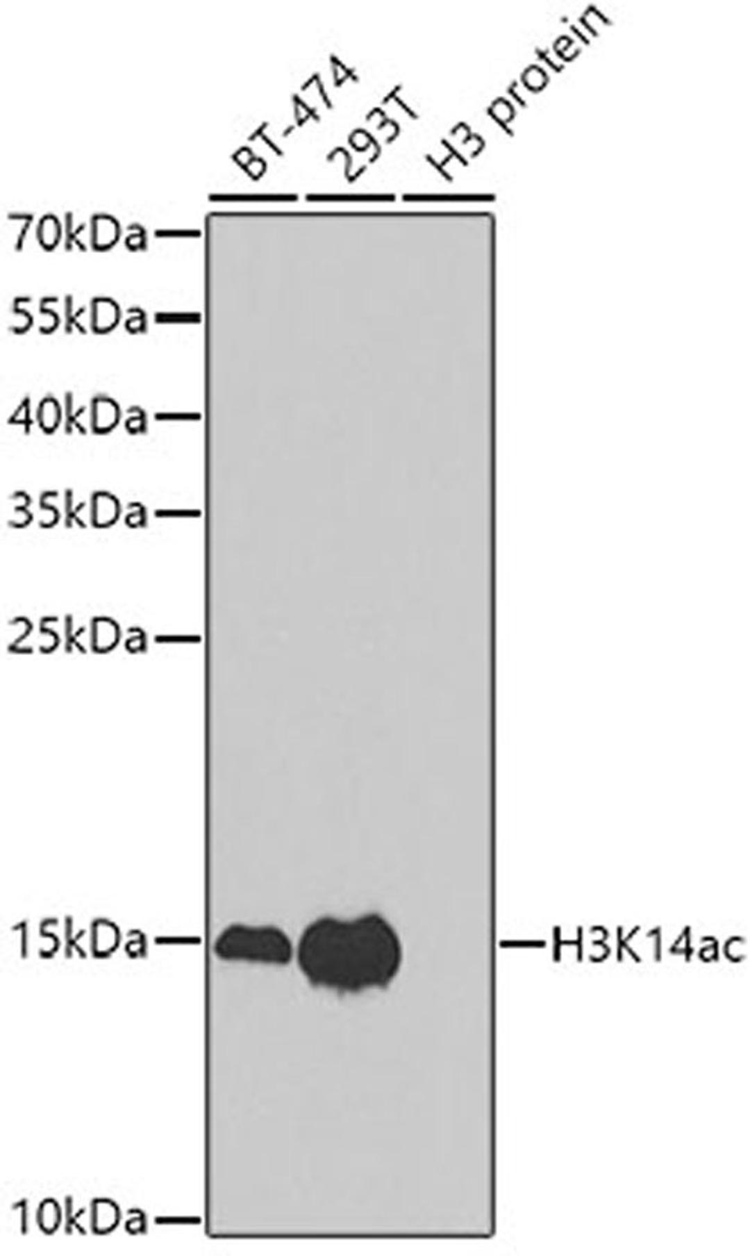 Western blot - Acetyl-Histone H3-K14 antibody (A7254)