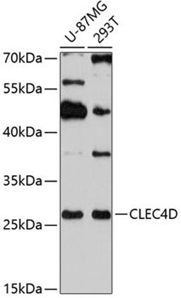 Western blot - CLEC4D antibody (A2697)