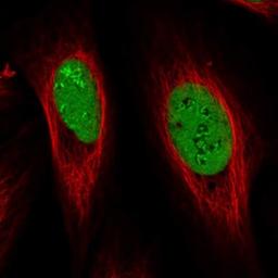 Immunocytochemistry/Immunofluorescence: NOLA1 Antibody [NBP2-31742] - Immunofluorescent staining of human cell line U-2 OS shows positivity in nucleus & nucleoli. Antibody staining is shown in green.