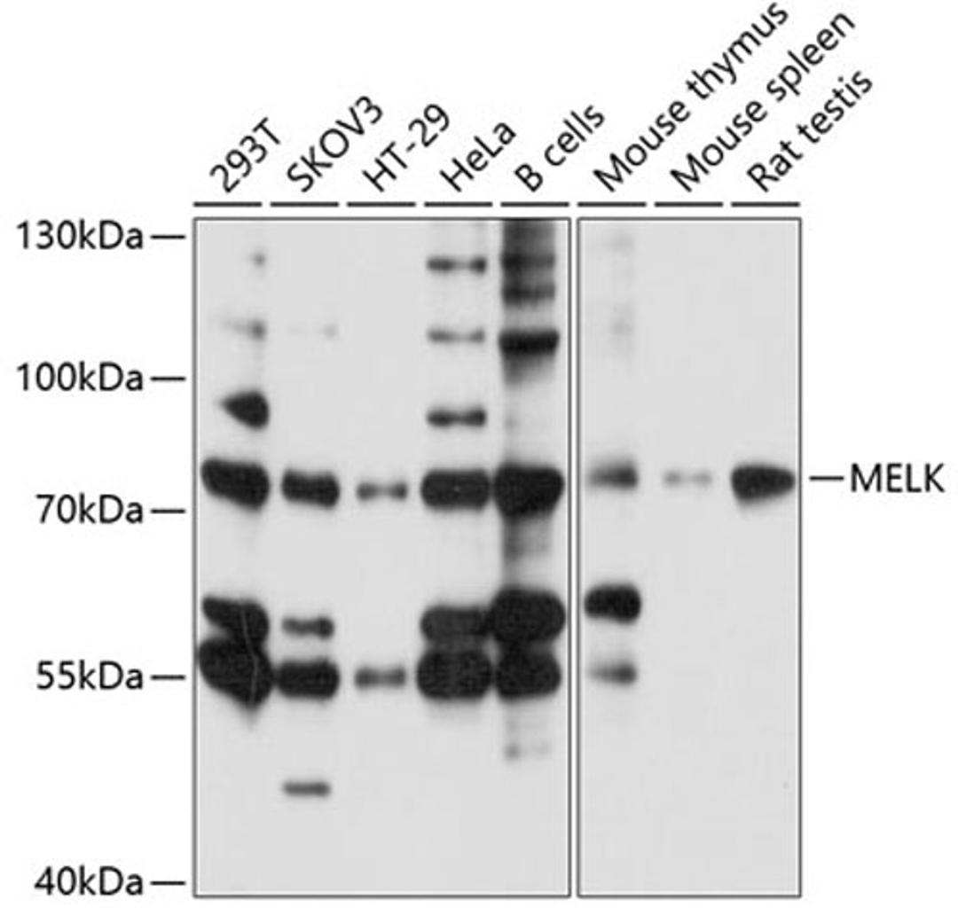 Western blot - MELK antibody (A10794)