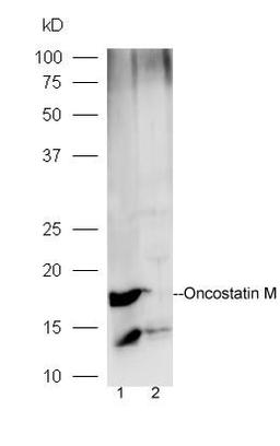 Western blot analysis of mouse brain lysates (Lane1), mouse muscle lysates (Lane2) using Oncostatin M antibody