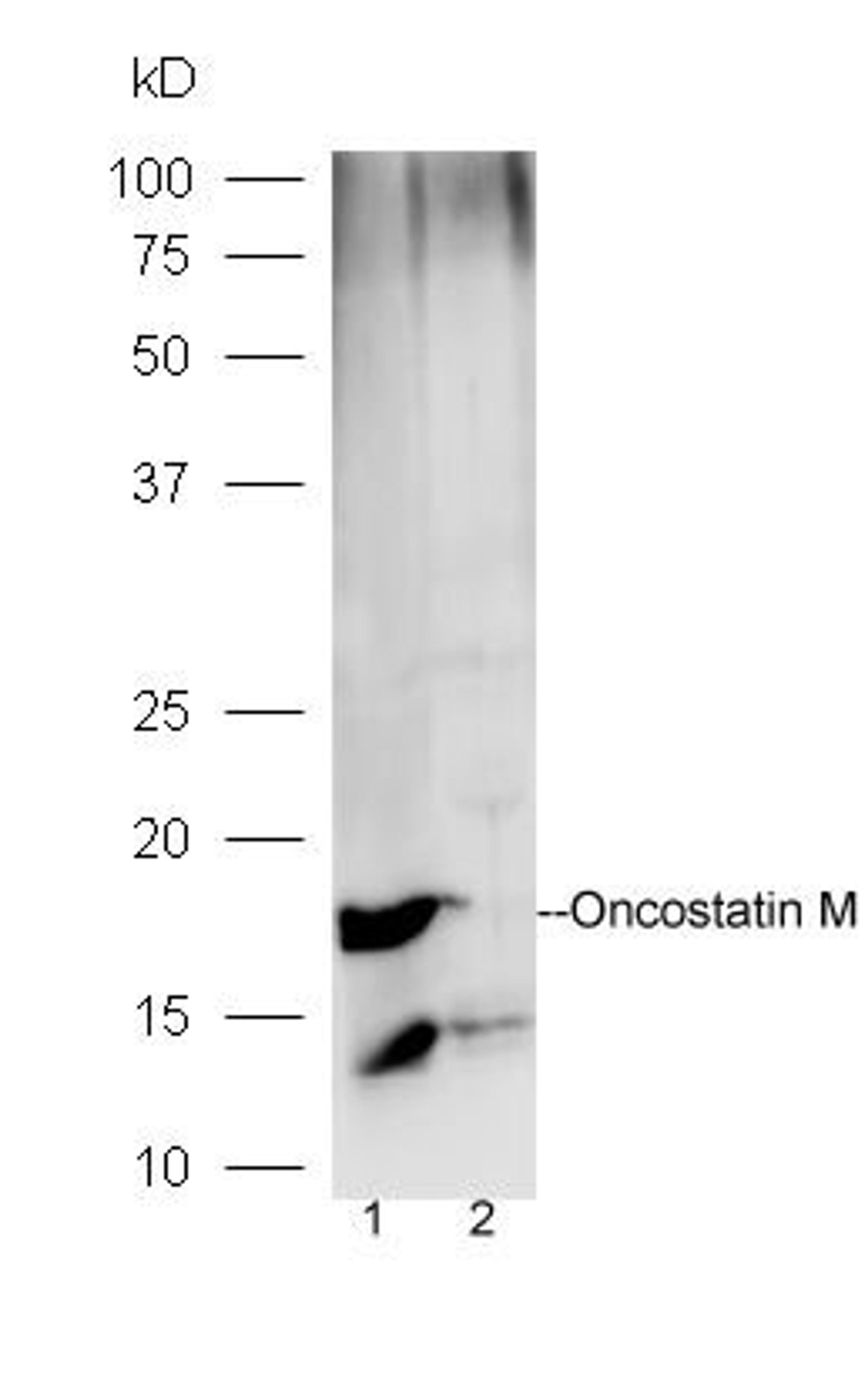 Western blot analysis of mouse brain lysates (Lane1), mouse muscle lysates (Lane2) using Oncostatin M antibody