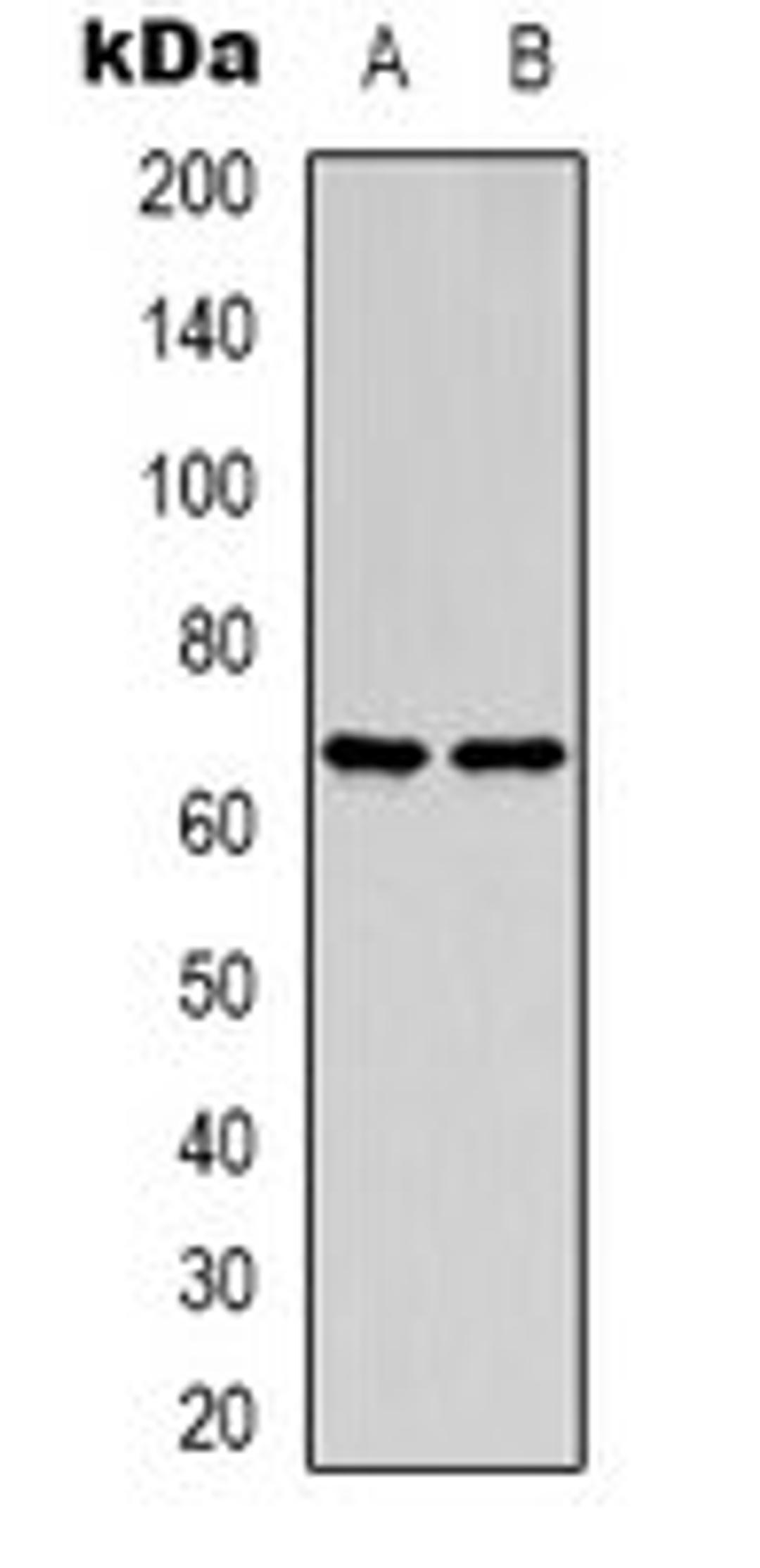 Western blot analysis of HepG2 (Lane 1), HEK293T (Lane 2) whole cell lysates using MENA antibody