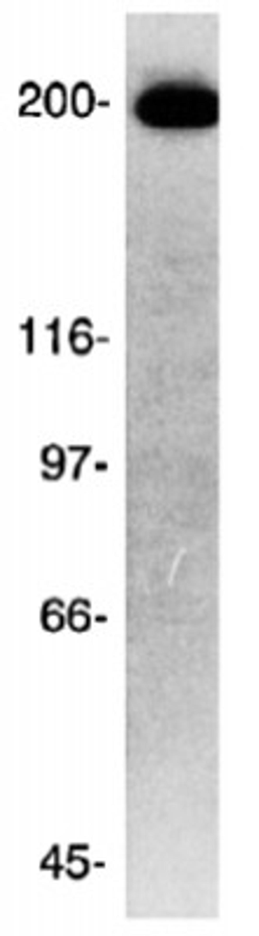 Western Blot: ch-TOG Antibody [NB500-182] - Specificity of polyclonal antibodies against ch-TOGp. Total cell protein (50 mg) from human HeLa cells was immunoblotted with a rabbit polyclonal serum generated against the C-terminal 301 amino acids of the ch-TOGp.