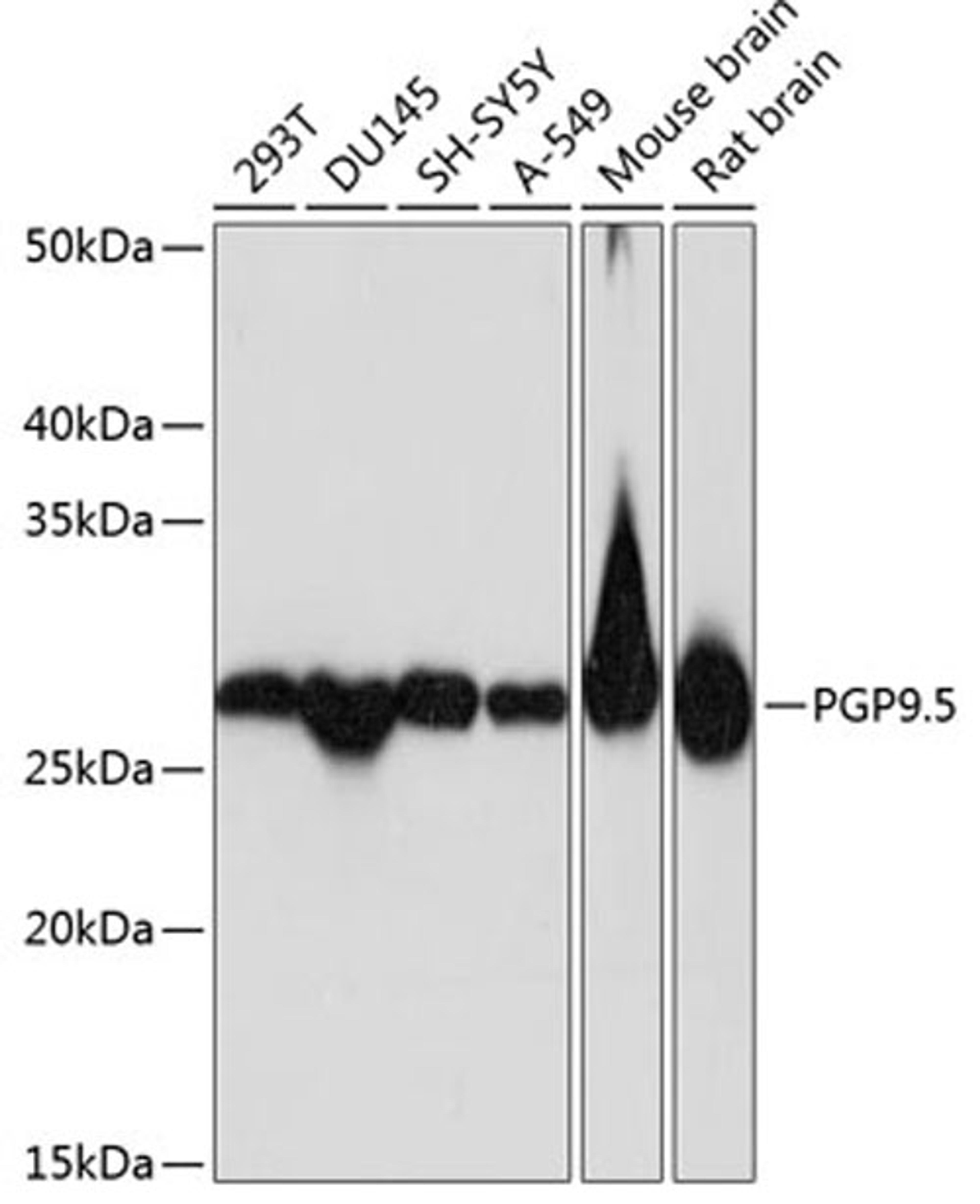 Western blot - PGP9.5 antibody (A19101)