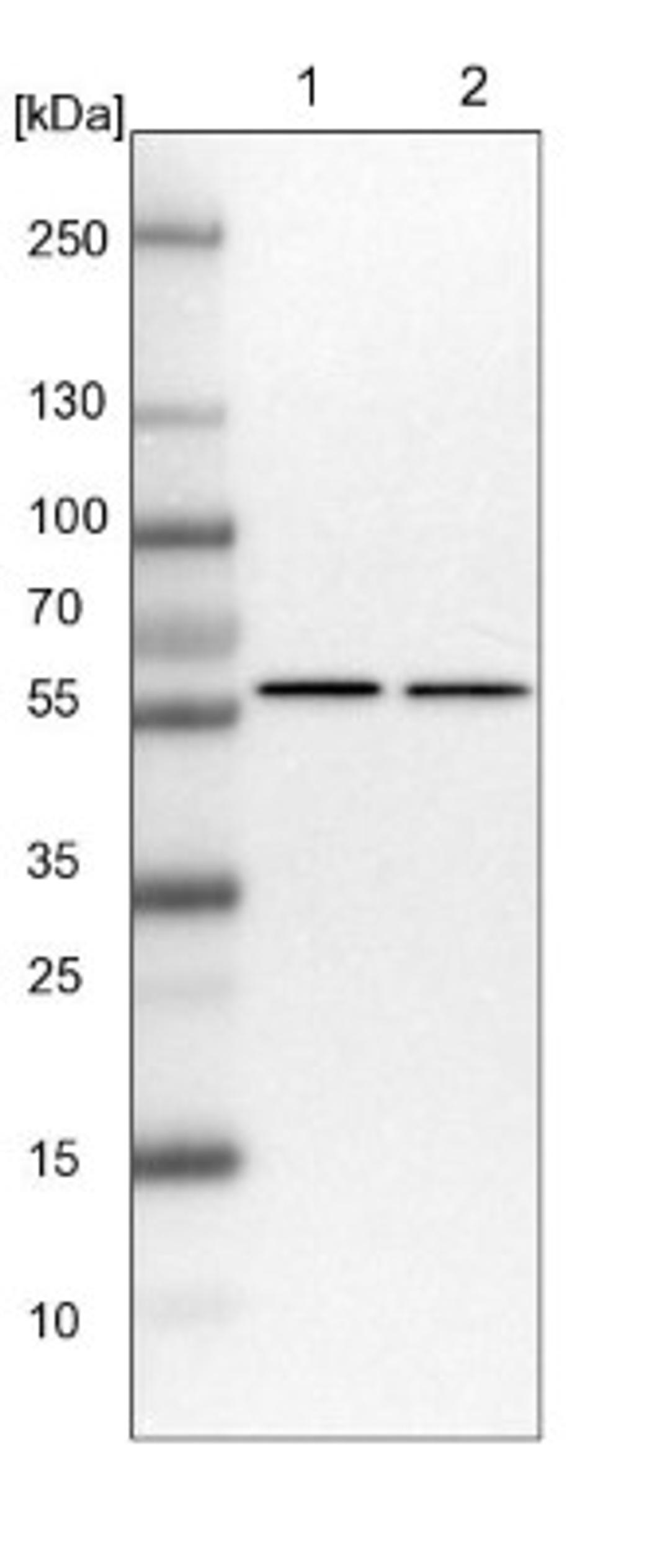 Western Blot: ZC3H15 Antibody [NBP1-81314] - Lane 1: NIH-3T3 cell lysate (Mouse embryonic fibroblast cells)<br/>Lane 2: NBT-II cell lysate (Rat Wistar bladder tumour cells)