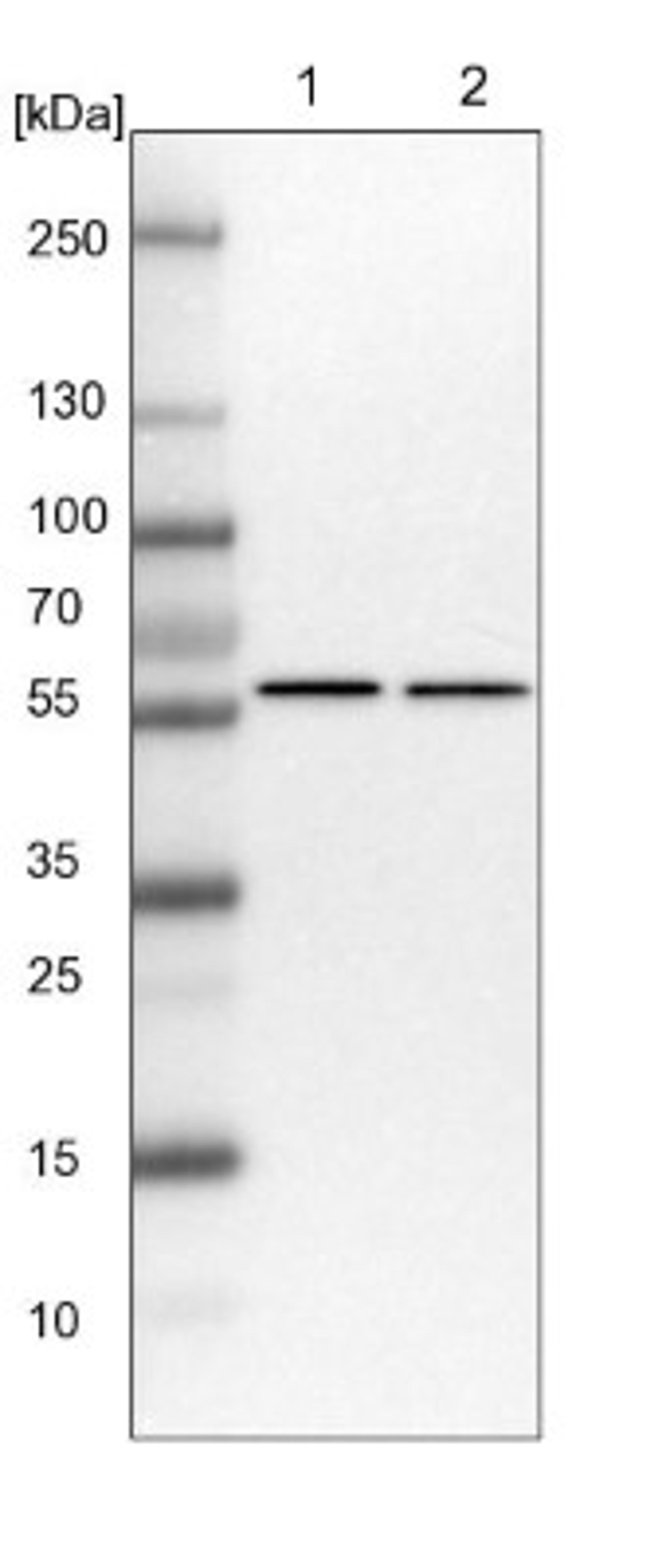 Western Blot: ZC3H15 Antibody [NBP1-81314] - Lane 1: NIH-3T3 cell lysate (Mouse embryonic fibroblast cells)<br/>Lane 2: NBT-II cell lysate (Rat Wistar bladder tumour cells)