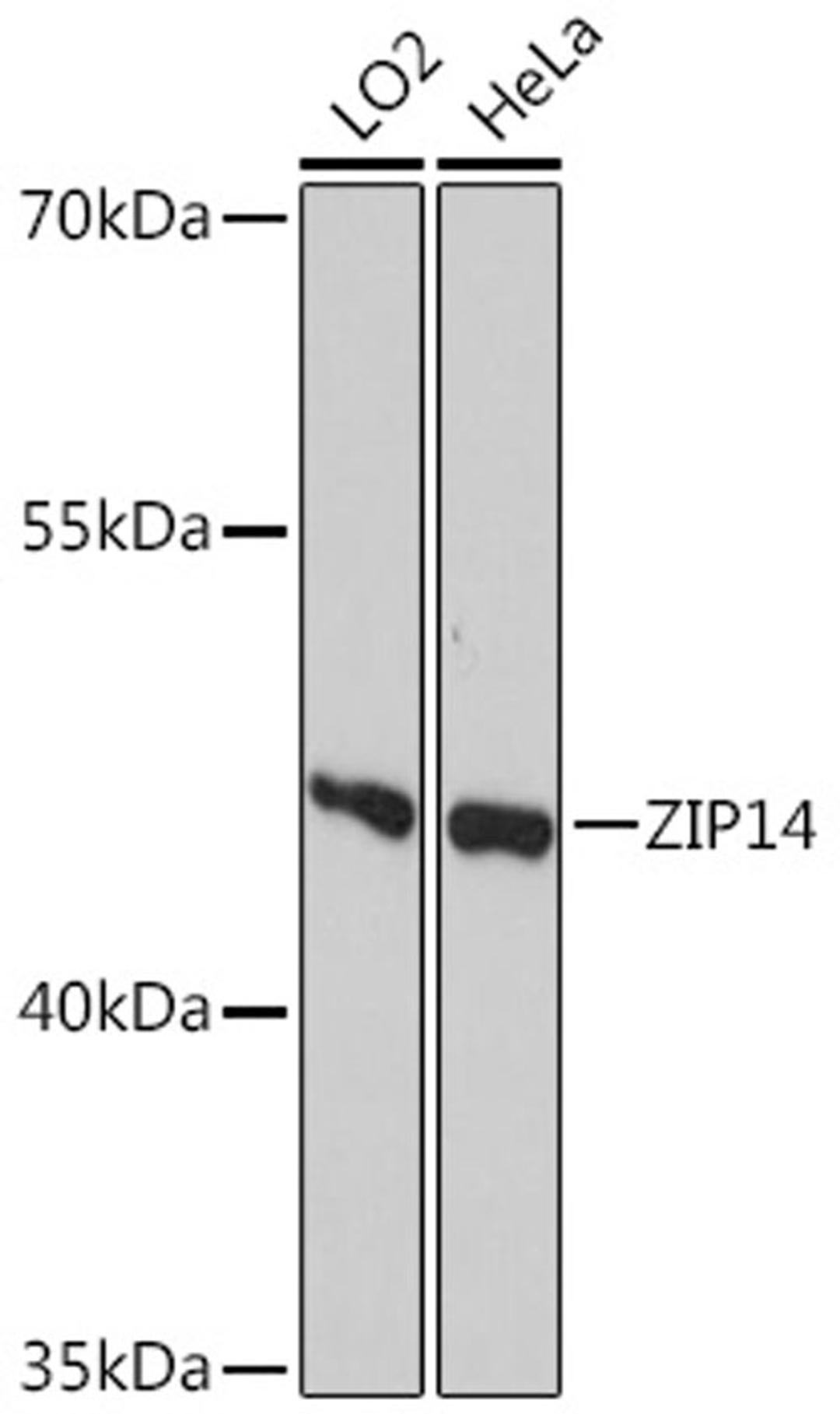 Western blot - ZIP14 antibody (A10413)