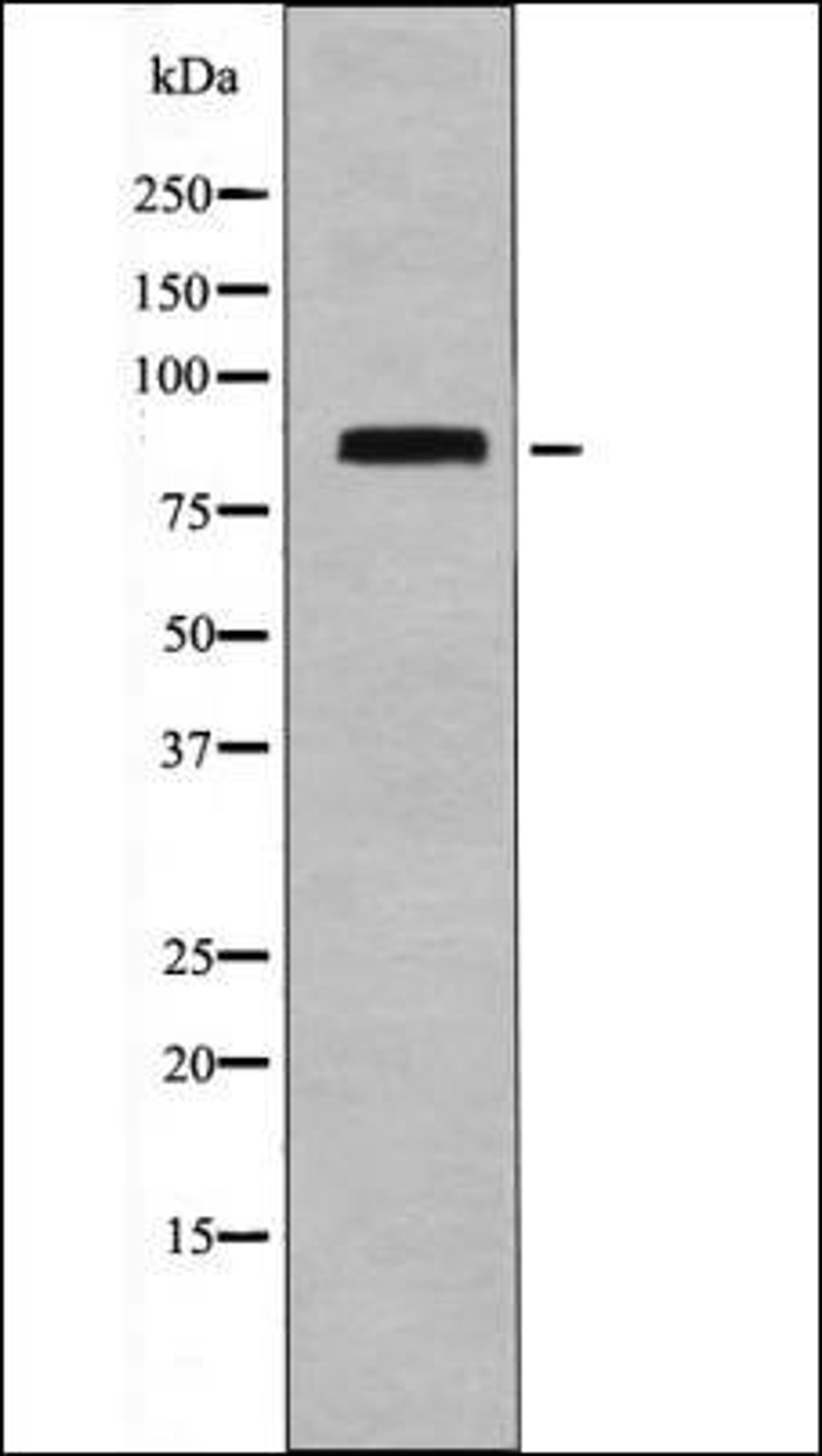 Western blot analysis of A2780 whole cell lysates using STAT4 -Phospho-Ser721- antibody