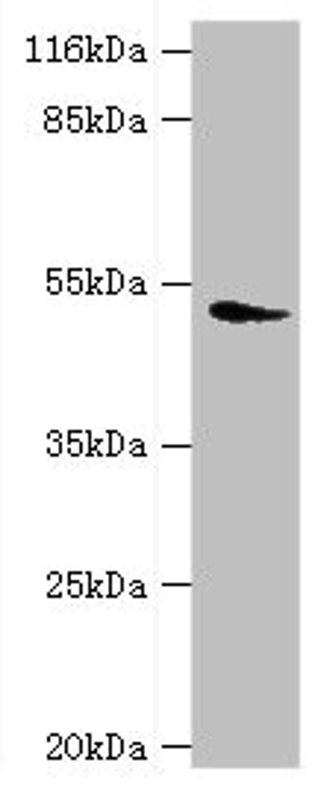 Western blot. All lanes: DRD5 antibody at 2µg/ml + Mouse brain tissue. Secondary. Goat polyclonal to rabbit IgG at 1/10000 dilution. Predicted band size: 53 kDa. Observed band size: 53 kDa