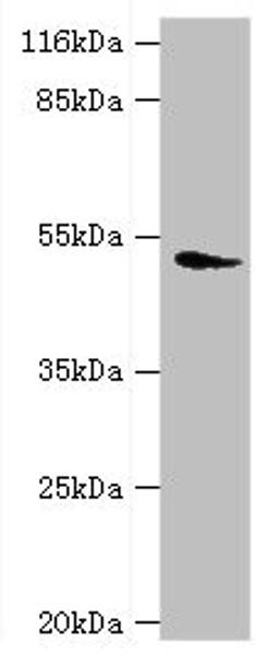 Western blot. All lanes: DRD5 antibody at 2µg/ml + Mouse brain tissue. Secondary. Goat polyclonal to rabbit IgG at 1/10000 dilution. Predicted band size: 53 kDa. Observed band size: 53 kDa