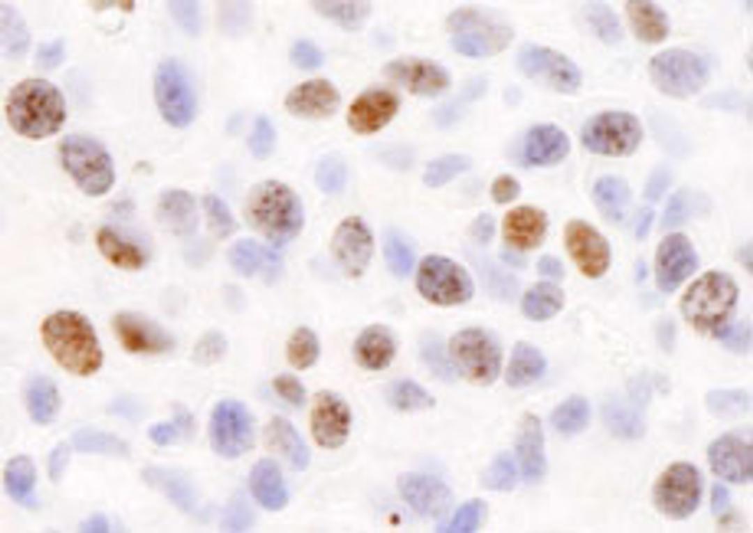 Detection of mouse H2AX by immunohistochemistry.