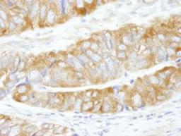 Detection of human CAD by immunohistochemistry.