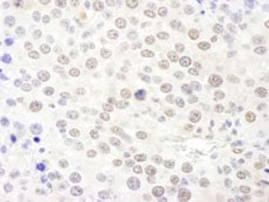 Detection of mouse NHP2L1 by immunohistochemistry.