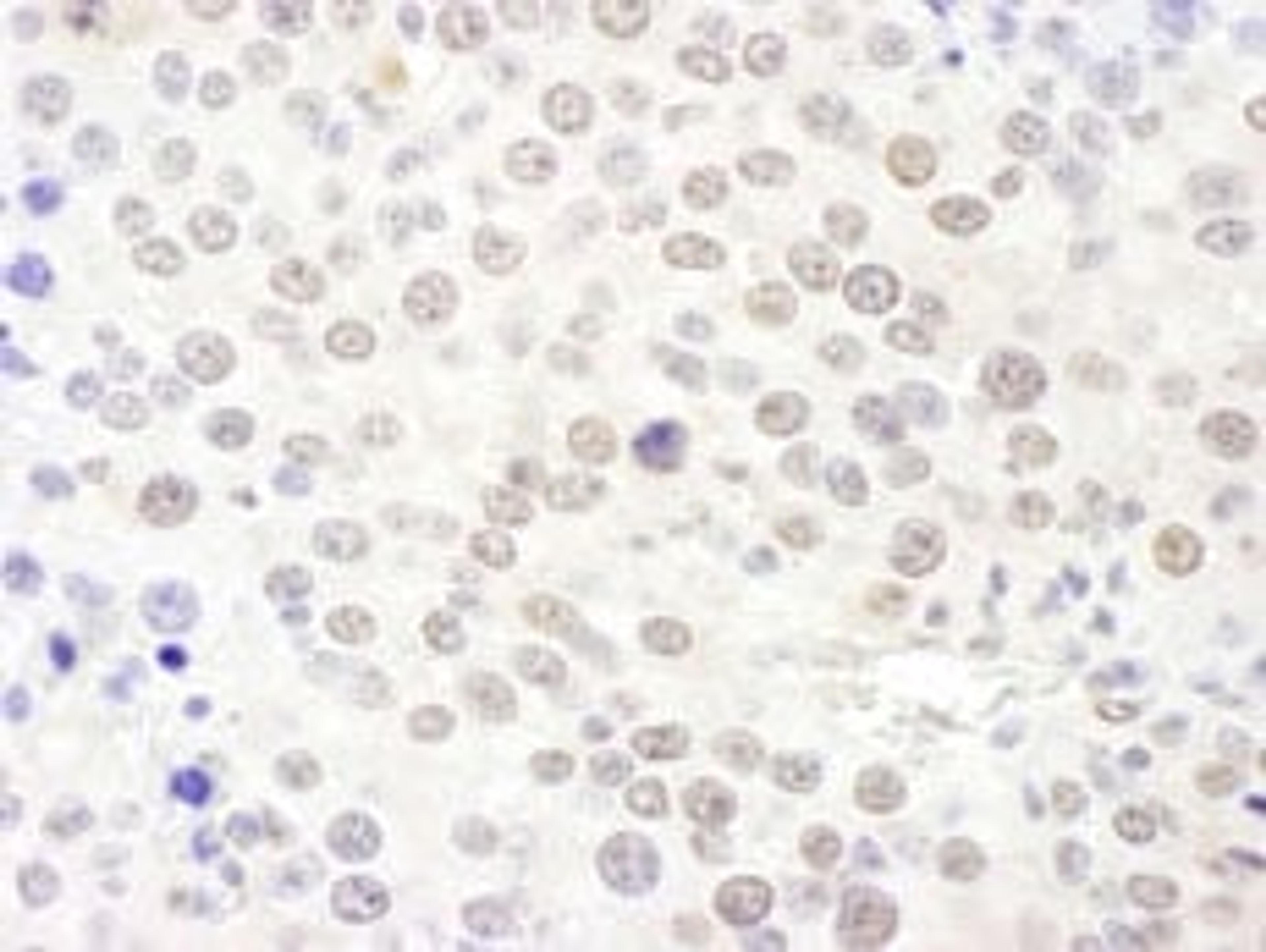 Detection of mouse NHP2L1 by immunohistochemistry.