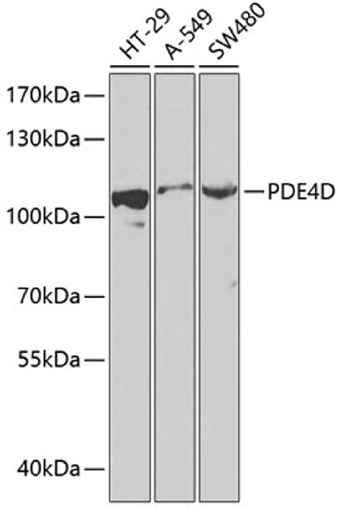 Western blot - PDE4D antibody (A13937)