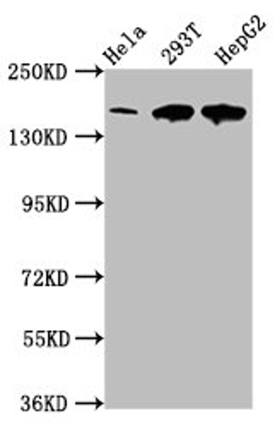 Western Blot. Positive WB detected in: Hela whole cell lysate, 293T whole cell lysate, HepG2 whole cell lysate. All lanes: LRPPRC antibody at 4µg/ml. Secondary. Goat polyclonal to rabbit IgG at 1/50000 dilution. Predicted band size: 158 kDa. Observed band size: 158 kDa