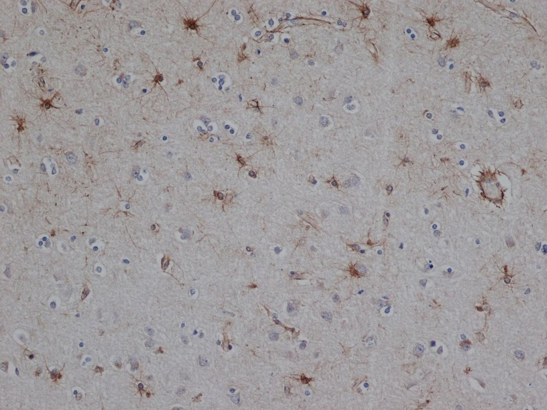 Staining of paraffin embedded human brain with Mouse anti Bovine GFAP following pronase treatment