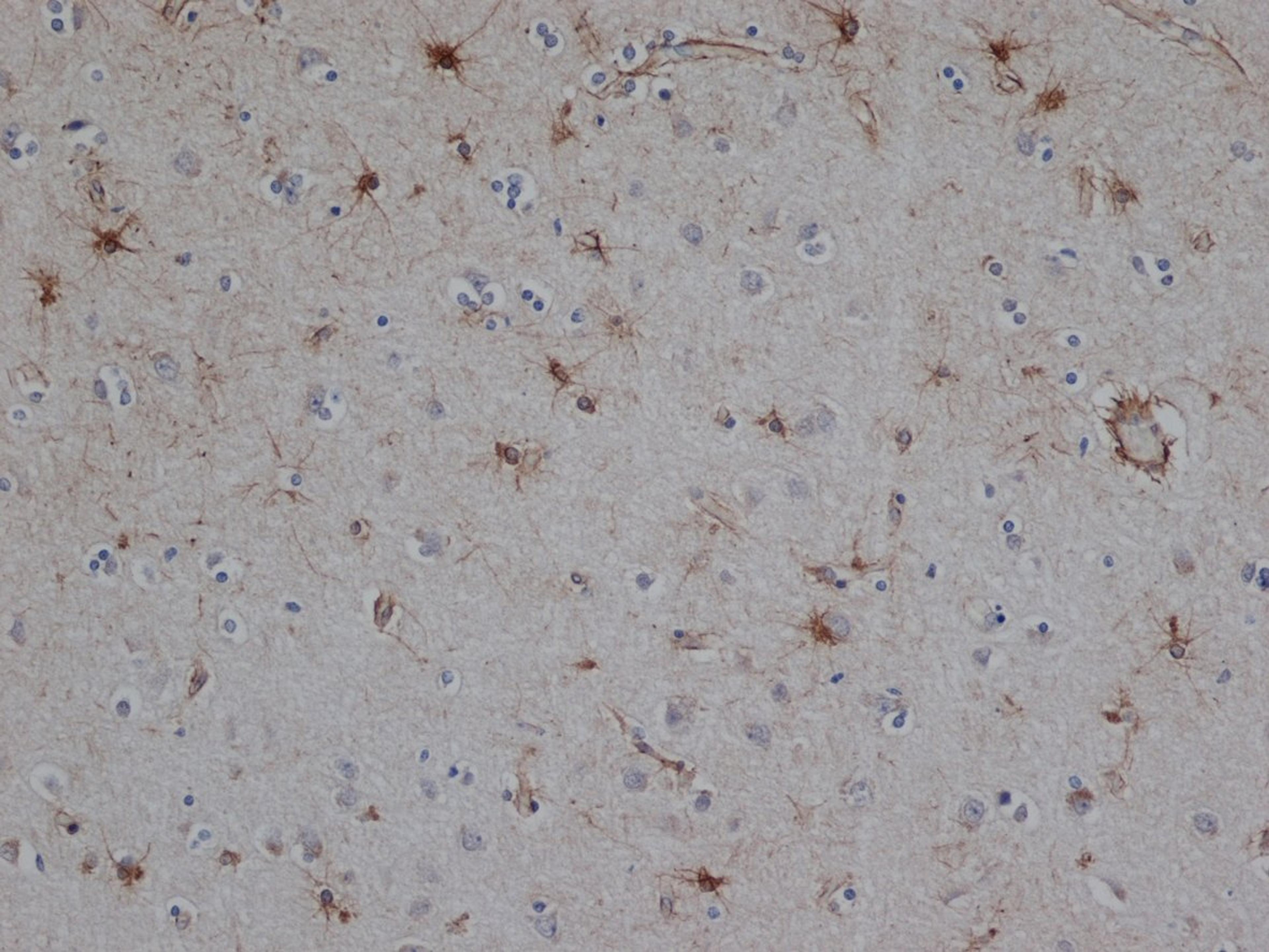 Staining of paraffin embedded human brain with Mouse anti Bovine GFAP following pronase treatment