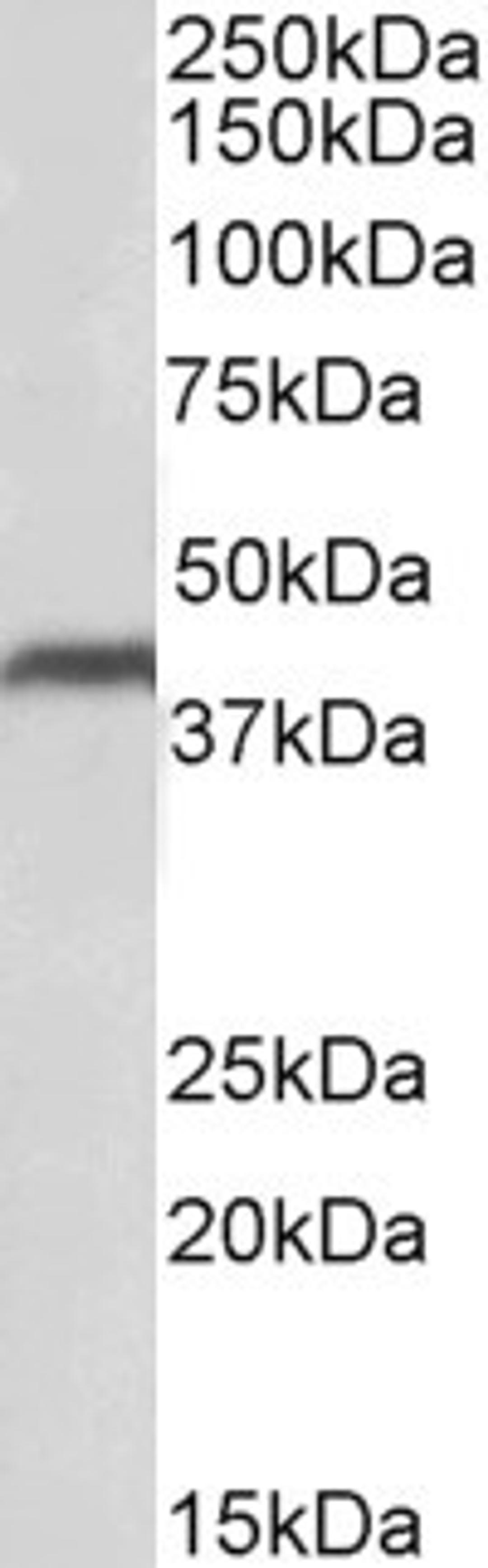 46-156 (0.1ug/ml) staining of Human Heart lysate (35ug protein in RIPA buffer). Primary incubation was 1 hour. Detected by chemiluminescence.