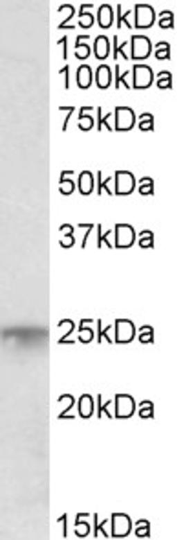 45-905 (1ug/ml) staining of Human Bone Marrow lysate (35ug protein in RIPA buffer). Primary incubation was 1 hour. Detected by chemiluminescence.