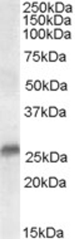 46-432 (0.3ug/ml) staining of Human Prostate lysate (35ug protein in RIPA buffer). Primary incubation was 1 hour. Detected by chemiluminescence.