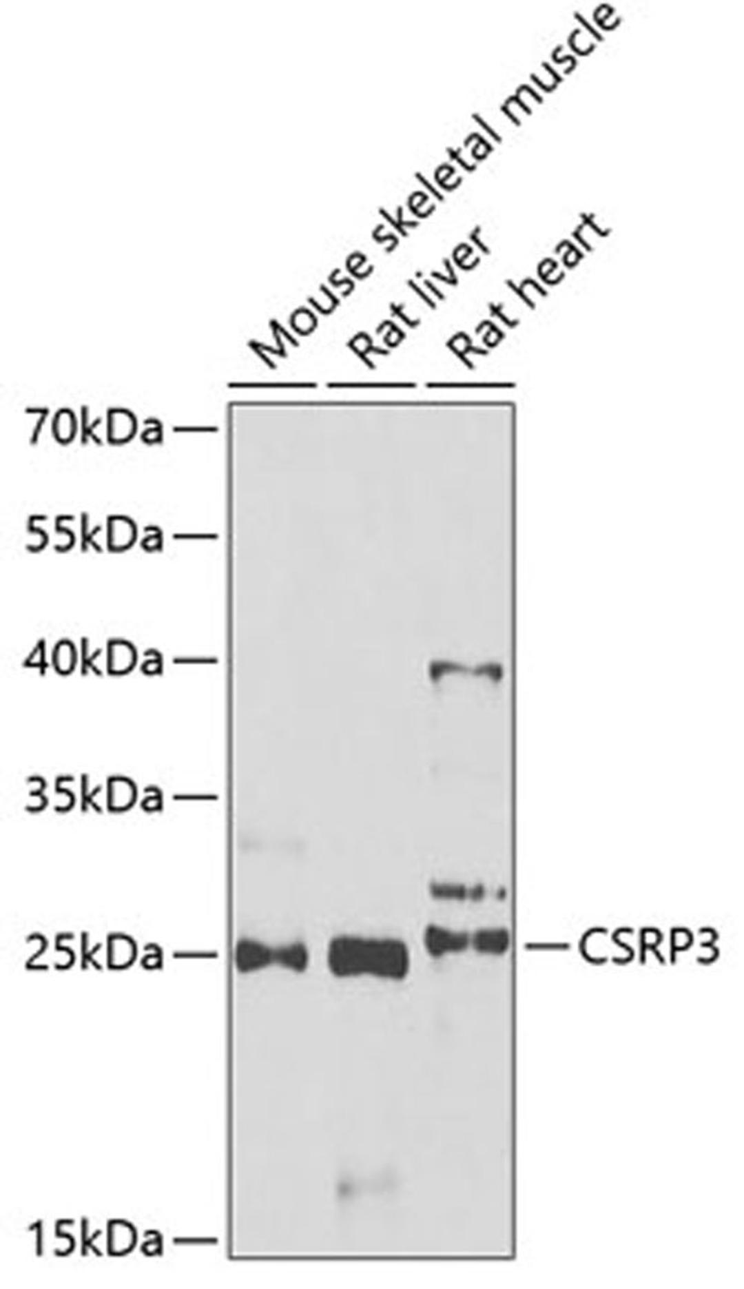 Western blot - CSRP3 antibody (A6569)