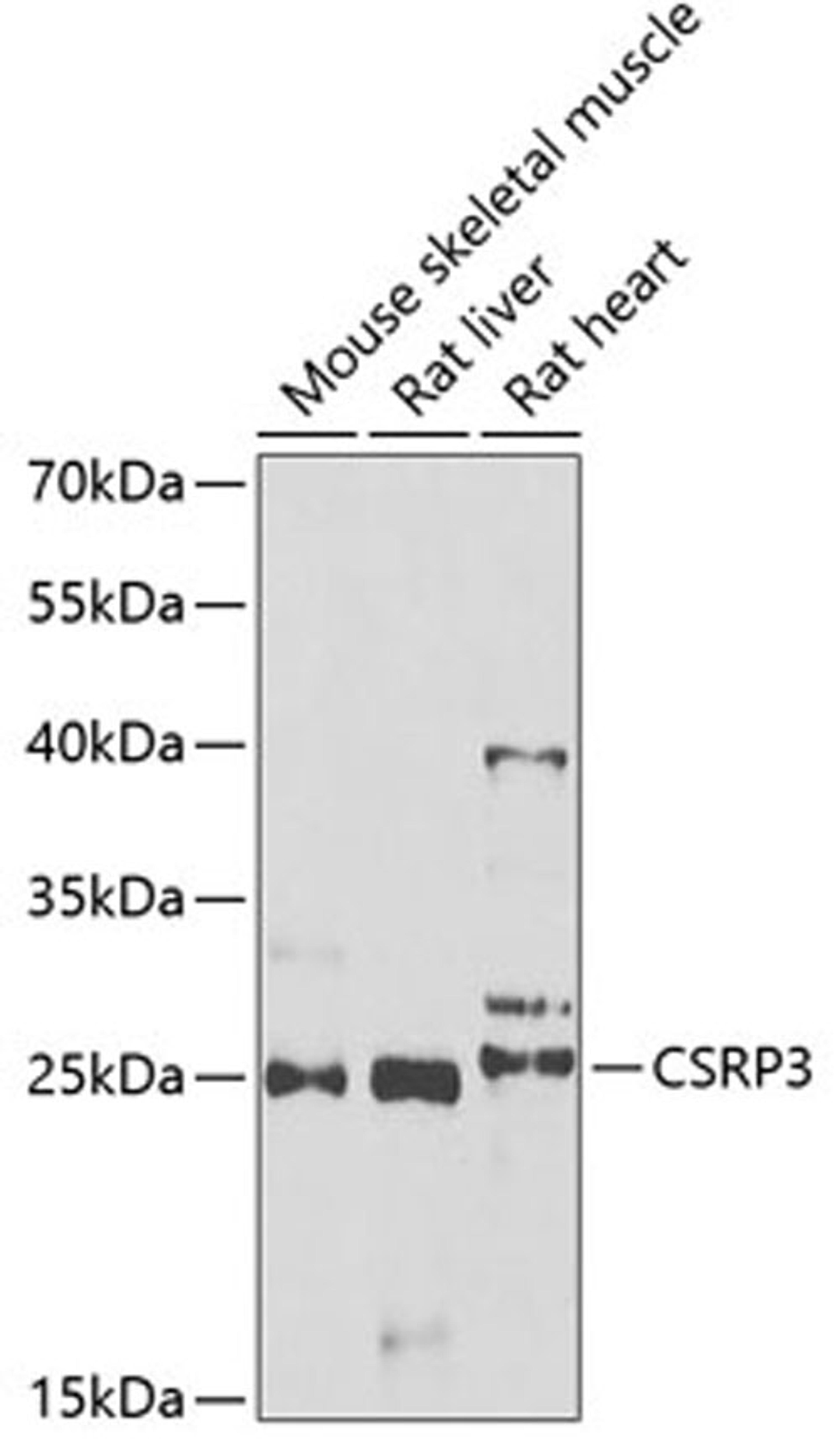 Western blot - CSRP3 antibody (A6569)