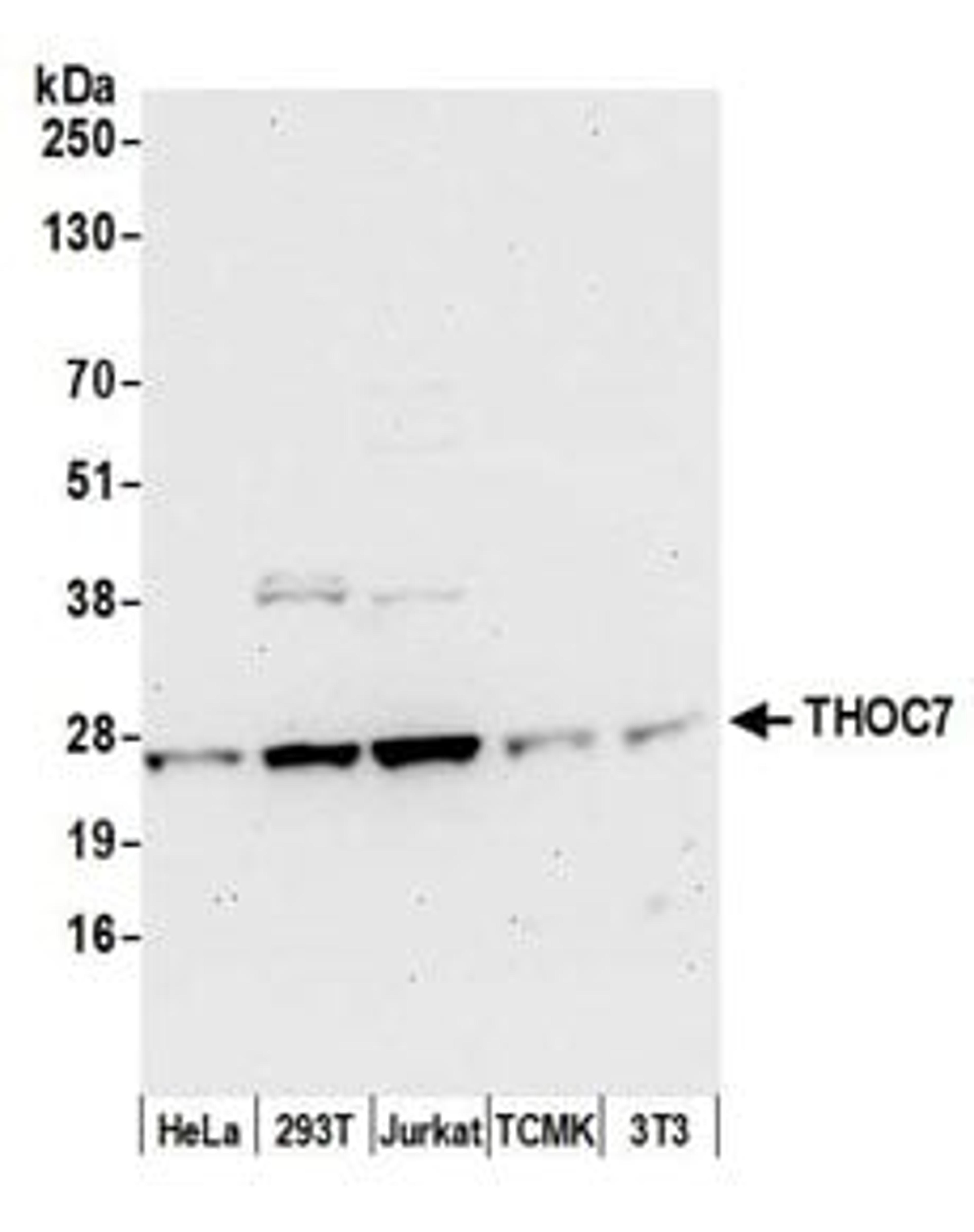 Detection of human and mouse THOC7 by western blot.