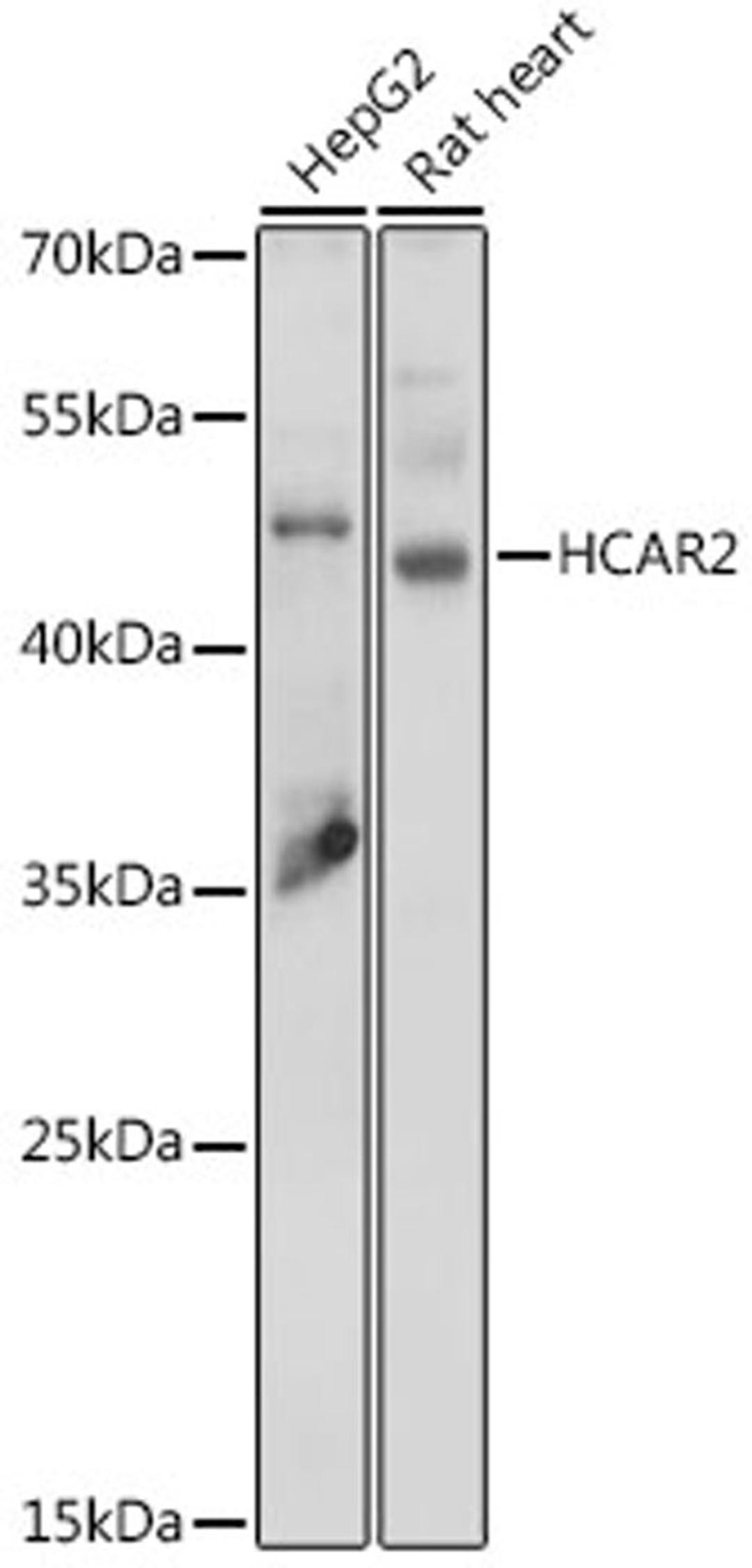 Western blot - HCAR2 antibody (A15611)