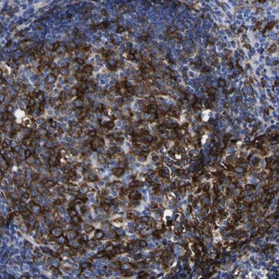 Immunohistochemistry-Paraffin: HLA DQA1 Antibody [NBP1-84550] - Staining of human tonsil shows strong cytoplasmic positivity in reaction center cells and lymphoid cells outside reaction centra.