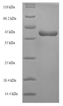 (Tris-Glycine gel) Discontinuous SDS-PAGE (reduced) with 5% enrichment gel and 15% separation gel.