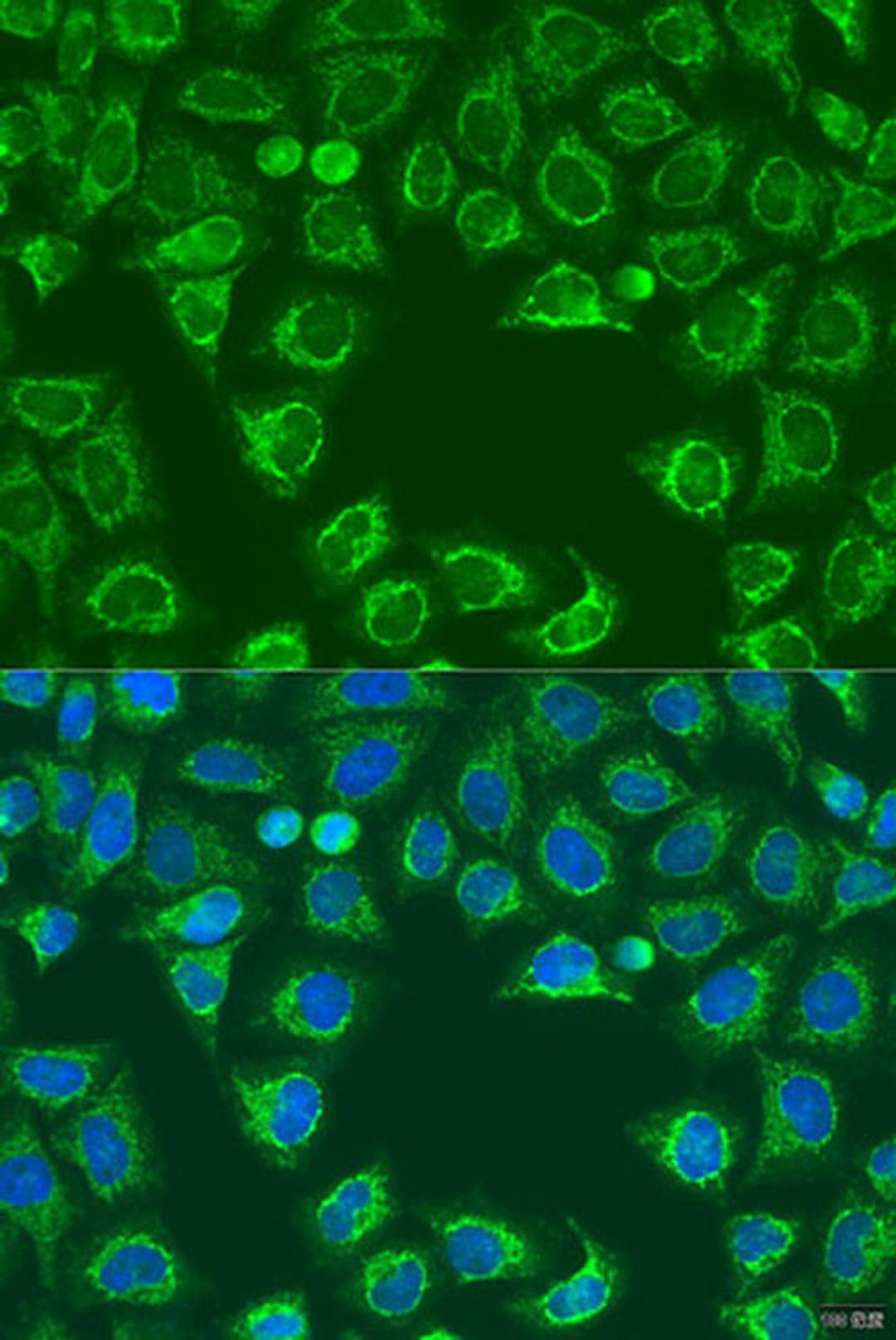 Immunofluorescence - ALG2 antibody (A15203)