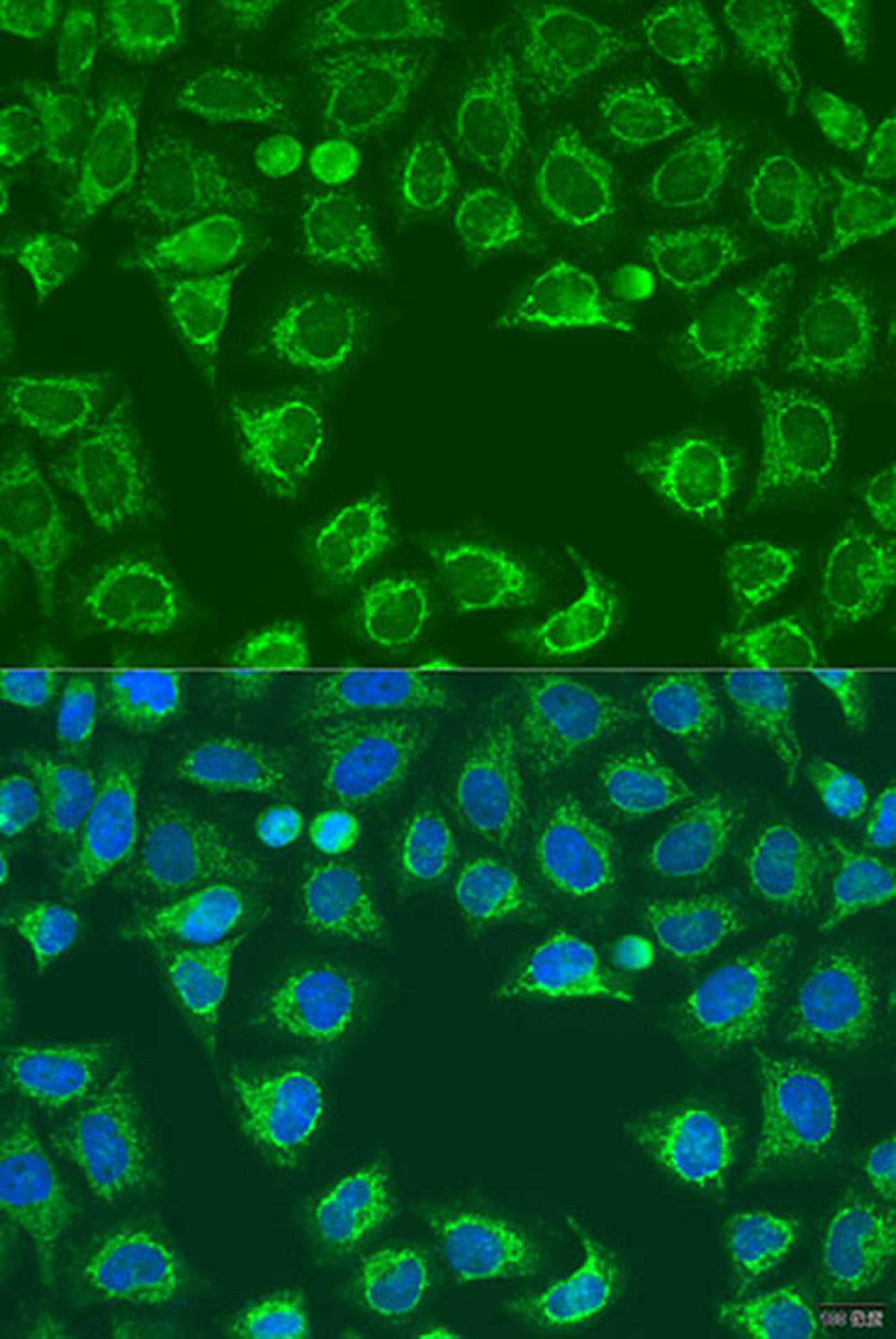 Immunofluorescence - ALG2 antibody (A15203)