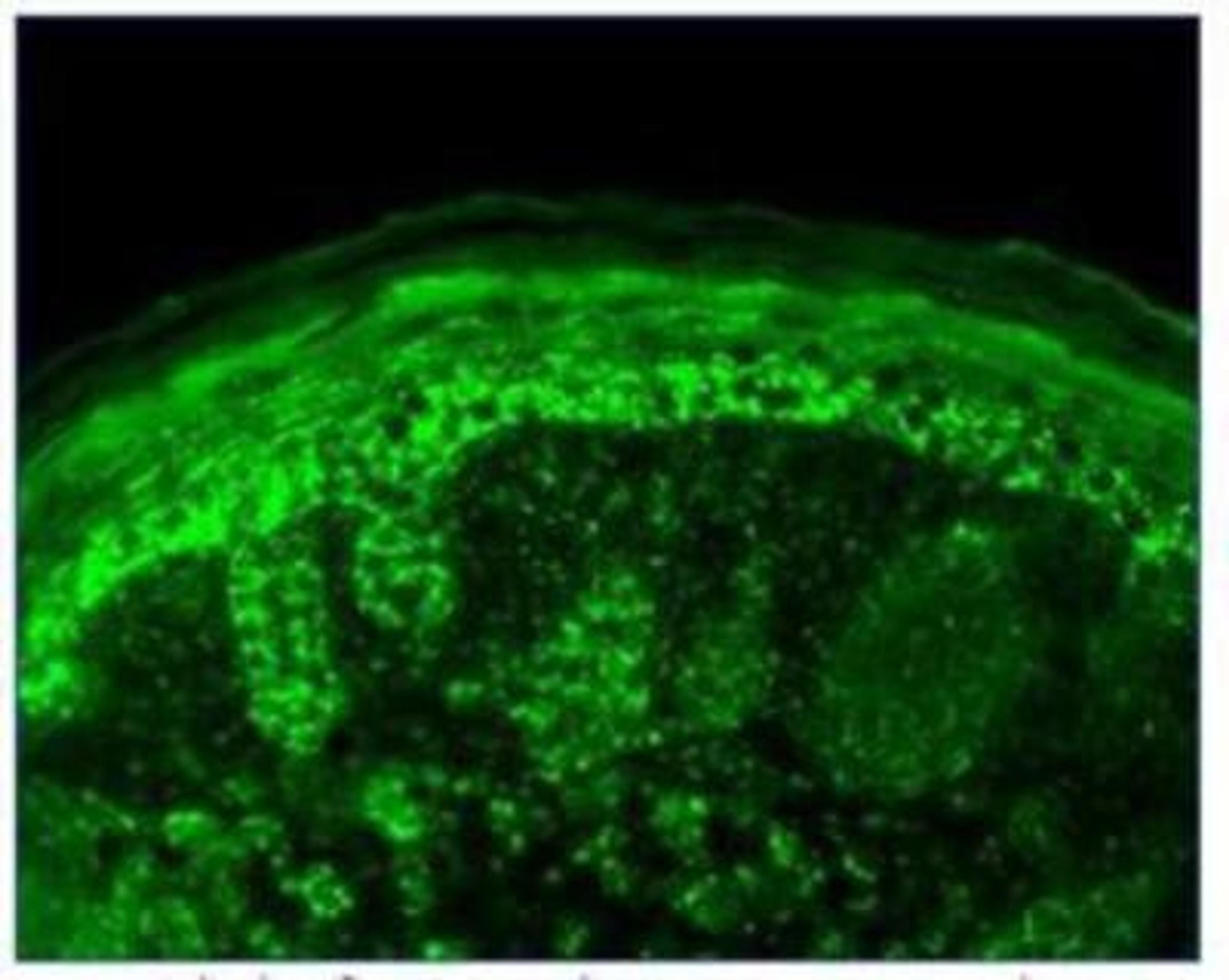 Immunohistochemistry: Hsp10 Antibody [NB110-11473] - Analysis of Cpn10 tested on mouse backskin sections of transgenic mice. Courtesy of Dr. Turksen, Ottawa Hospital Reasearch Institute, Canada.