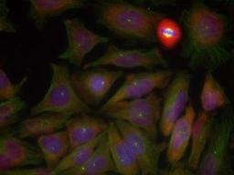 Immunocytochemistry/Immunofluorescence: PTEN [p Ser380, p Thr382, p Thr383] Antibody [NB100-82166] - Methanol-fixed Hela cells using PTEN (Phospho-Ser380/Thr382/Thr383)