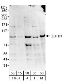 Detection of human and mouse ZBTB1 by western blot.