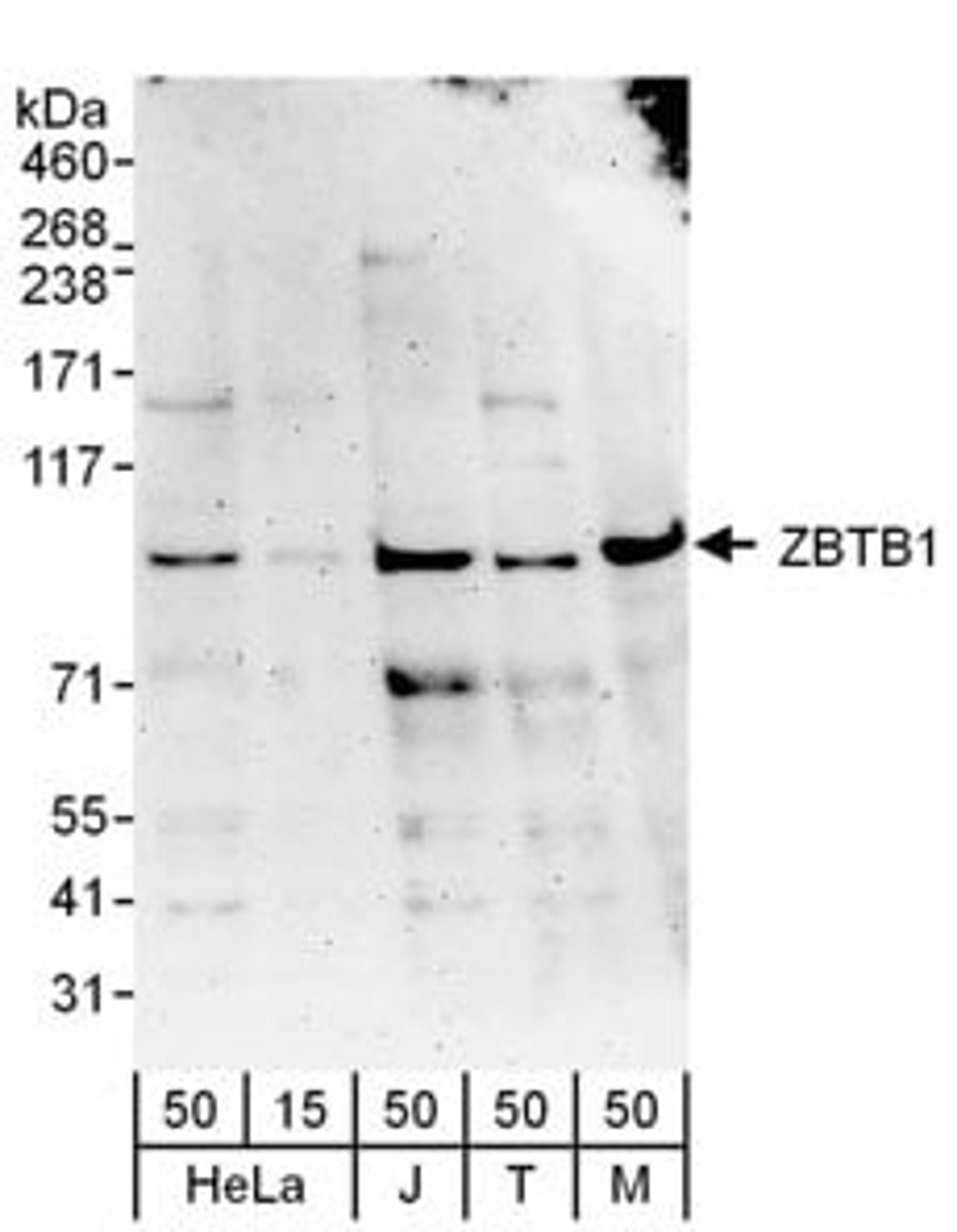 Detection of human and mouse ZBTB1 by western blot.