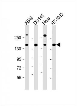 Western Blot at 1:1000 dilution Lane 1: A549 whole cell lysate Lane 2: DU145 whole cell lysate Lane 3: Hela whole cell lysate Lane 4: HT-1080 whole cell lysate Lysates/proteins at 20 ug per lane.