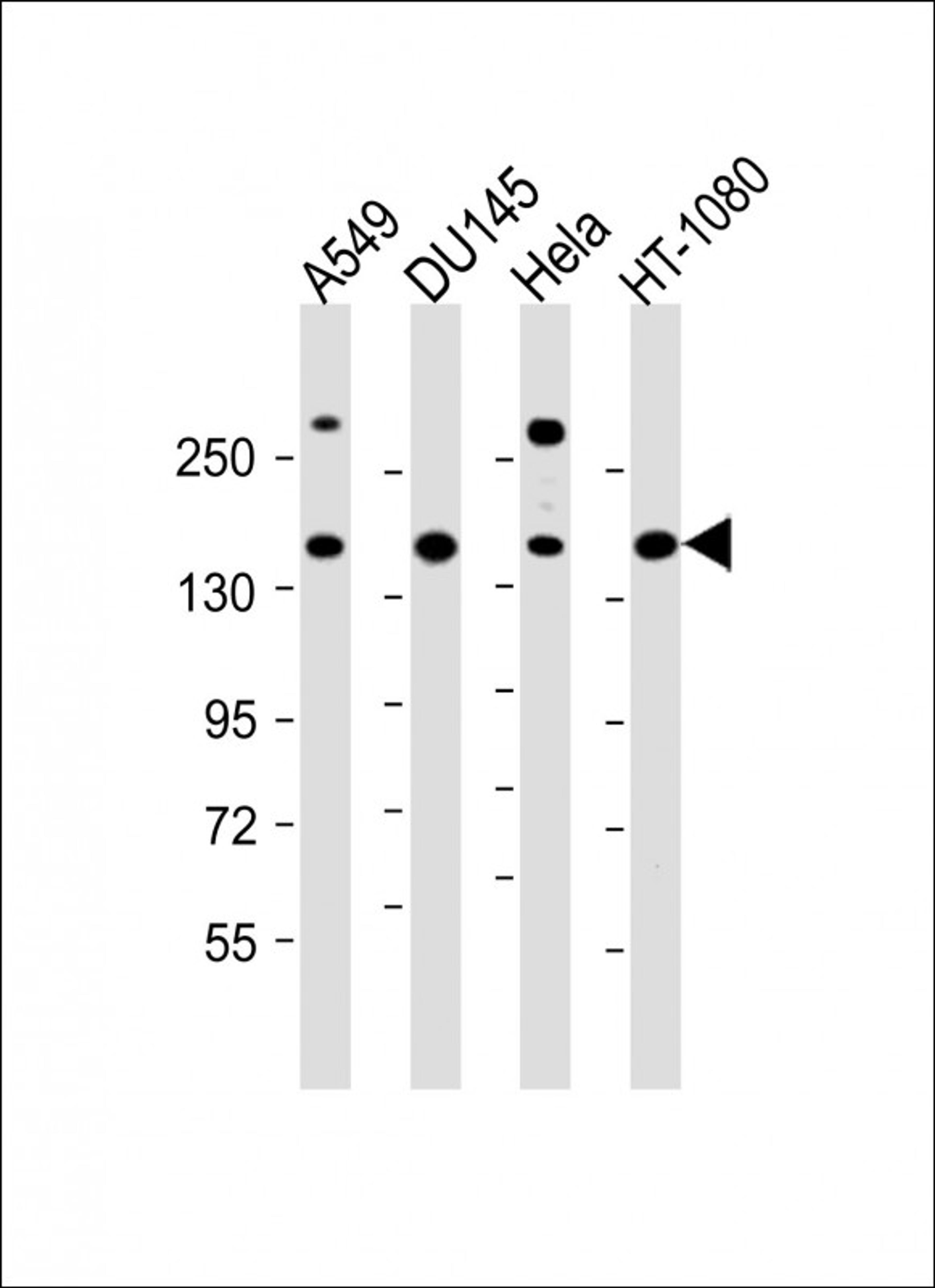 Western Blot at 1:1000 dilution Lane 1: A549 whole cell lysate Lane 2: DU145 whole cell lysate Lane 3: Hela whole cell lysate Lane 4: HT-1080 whole cell lysate Lysates/proteins at 20 ug per lane.