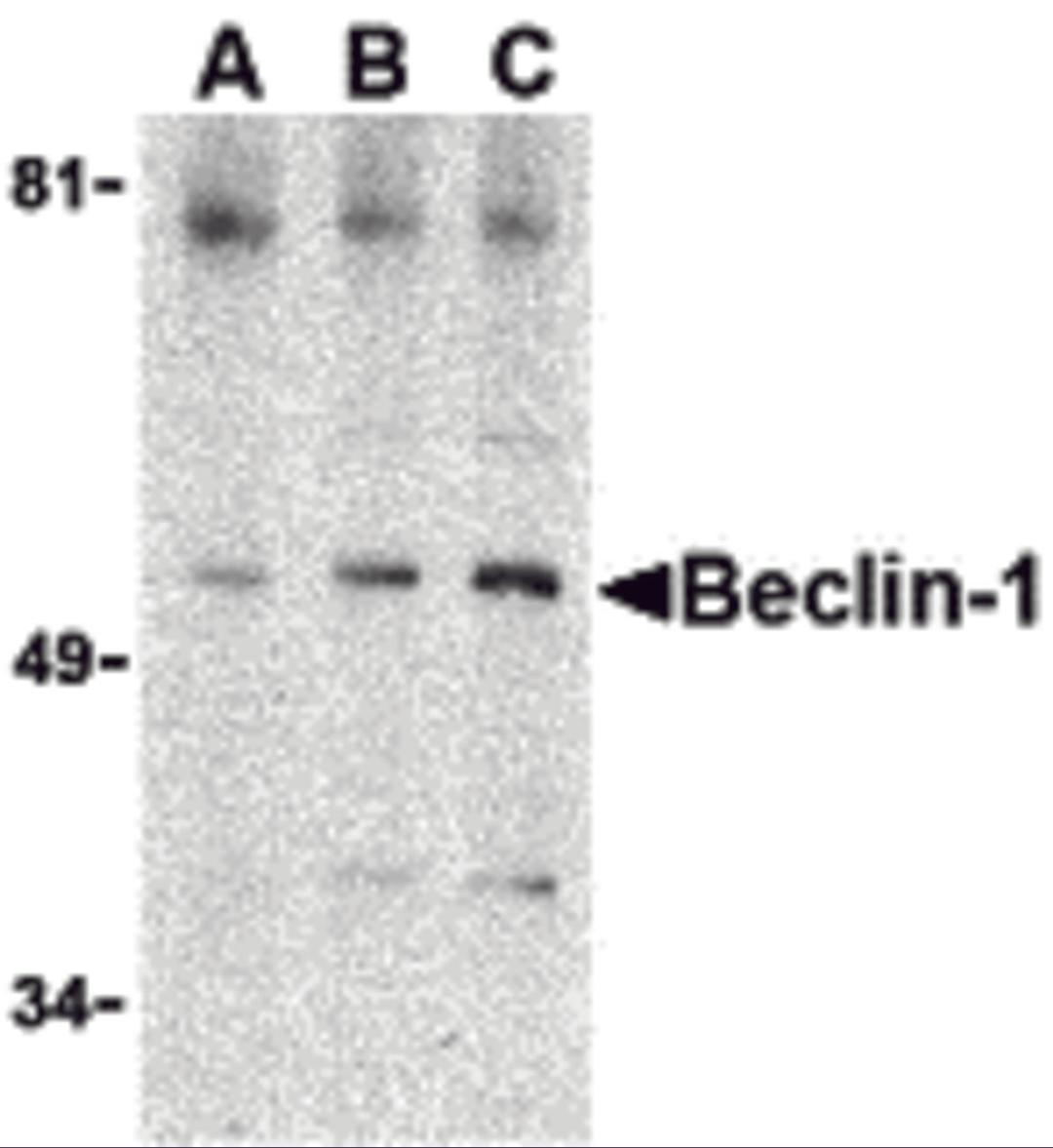 Western blot analysis of Beclin-1 in A431 cell lysate with Beclin-1 antibody at (A) 0.5, (B) 1 and (C) 2 μg/mL.