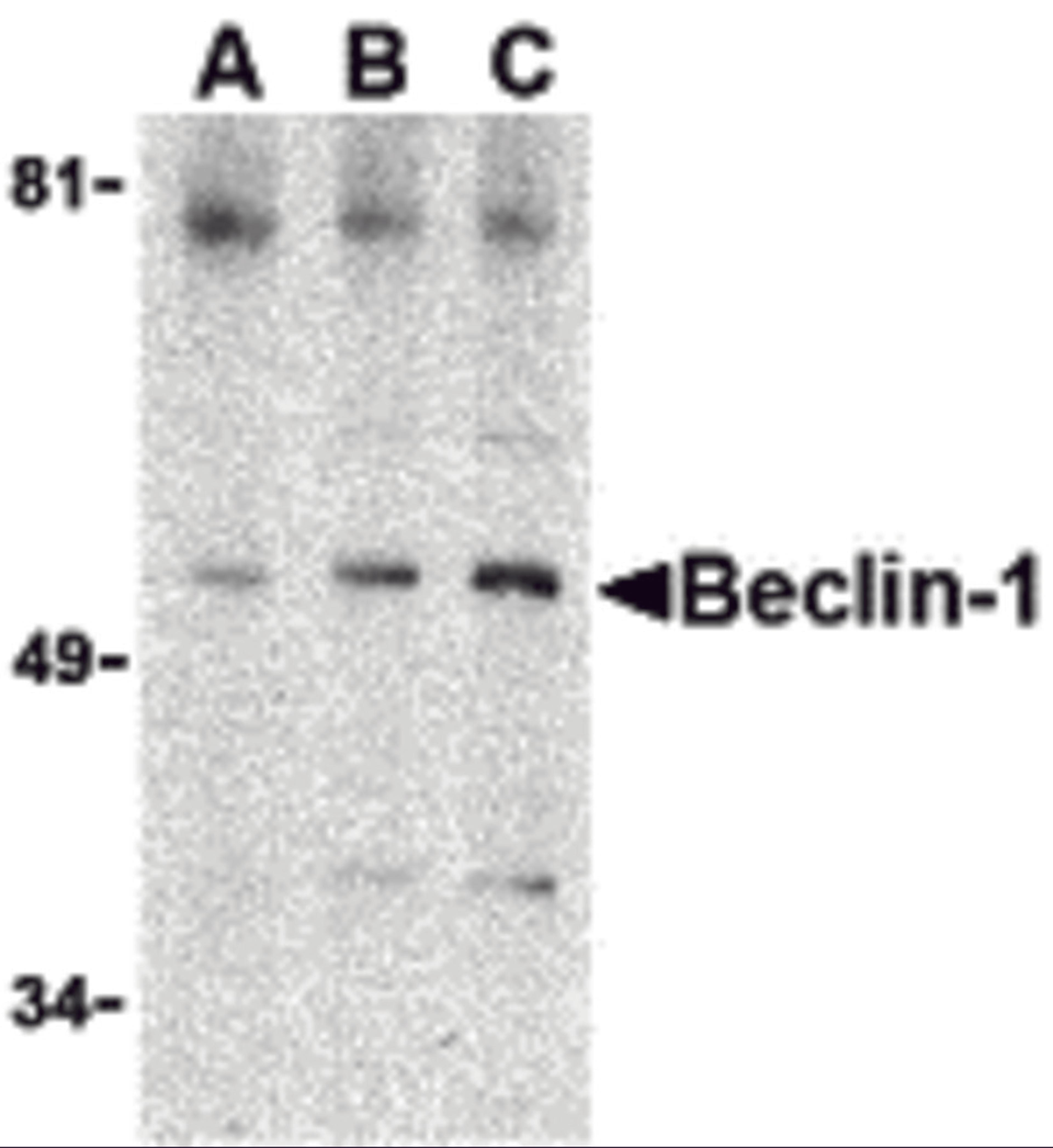 Western blot analysis of Beclin-1 in A431 cell lysate with Beclin-1 antibody at (A) 0.5, (B) 1 and (C) 2 μg/mL.
