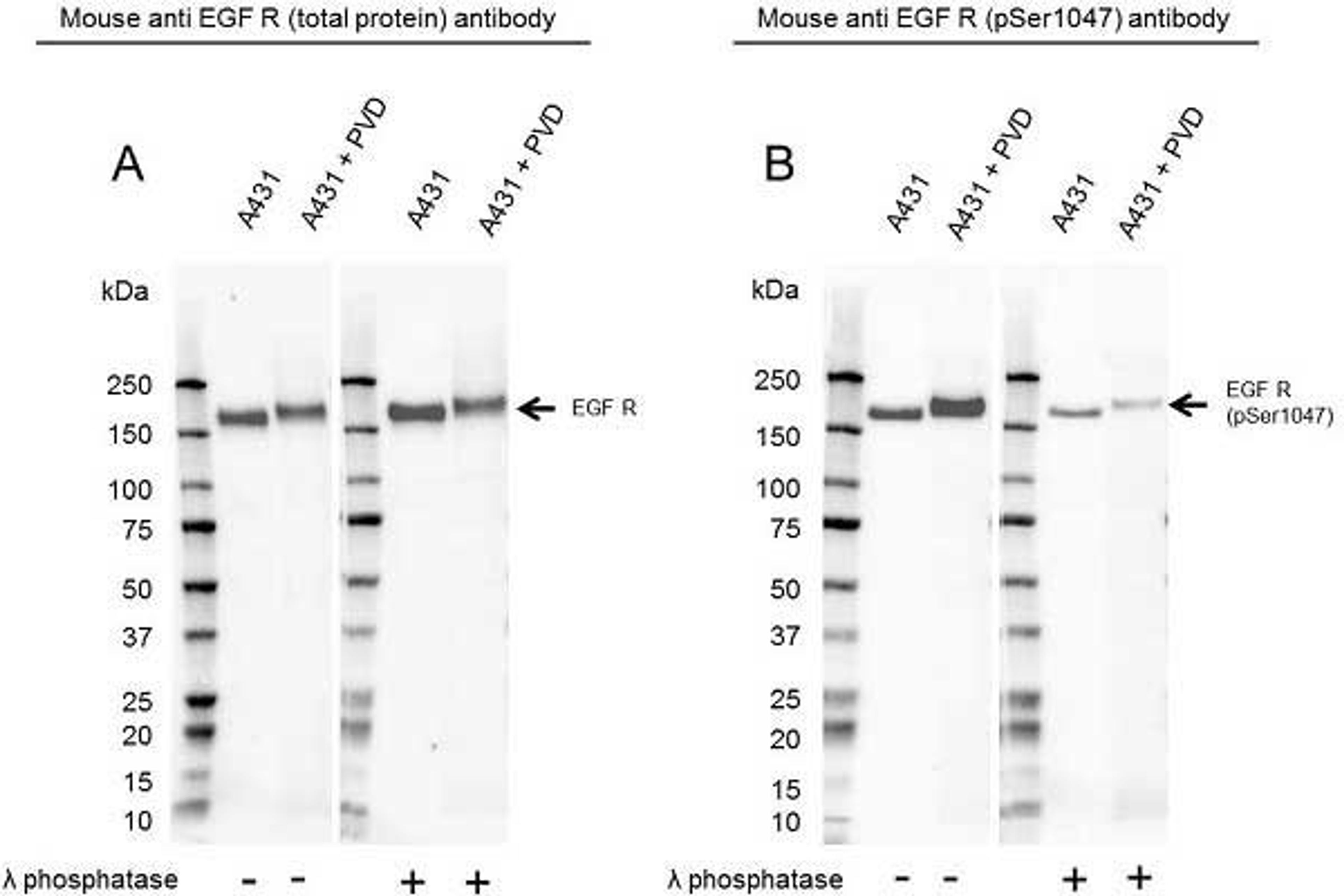 Western Blot analysis of A431 untreated and pervanadate treated whole cell lysates