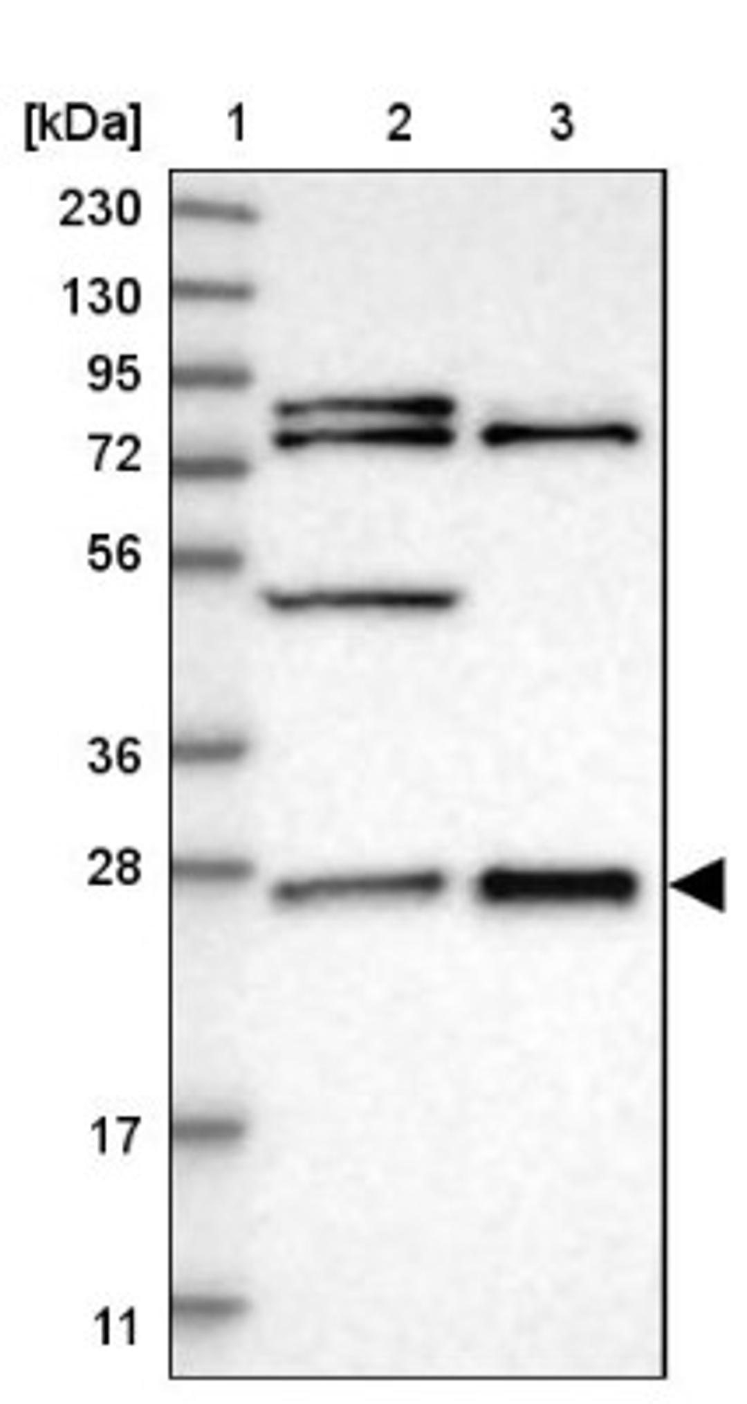 Western Blot: GRPEL2 Antibody [NBP1-85099] - Lane 1: Marker [kDa] 230, 130, 95, 72, 56, 36, 28, 17, 11<br/>Lane 2: Human cell line RT-4<br/>Lane 3: Human cell line U-251MG sp