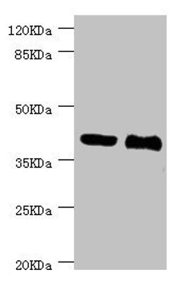 Western blot. All lanes: NHLRC1 antibody at 3.13ug/ml. Lane 1: LO2 whole cell lysate. Lane 2: Rat liver tissue. Secondary. Goat polyclonal to rabbit IgG at 1/10000 dilution. Predicted band size: 42 kDa. Observed band size: 42 kDa.